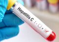 Hepatitis scare