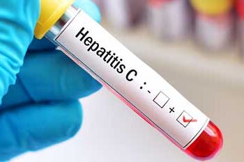Hepatitis scare
