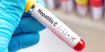 Hepatitis scare