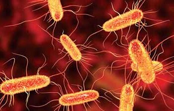 E coli
