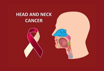Head and neck cancers on the rise in India, youth at risk