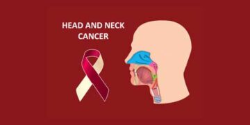 Head and neck cancers on the rise in India, youth at risk