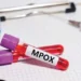 mpox
